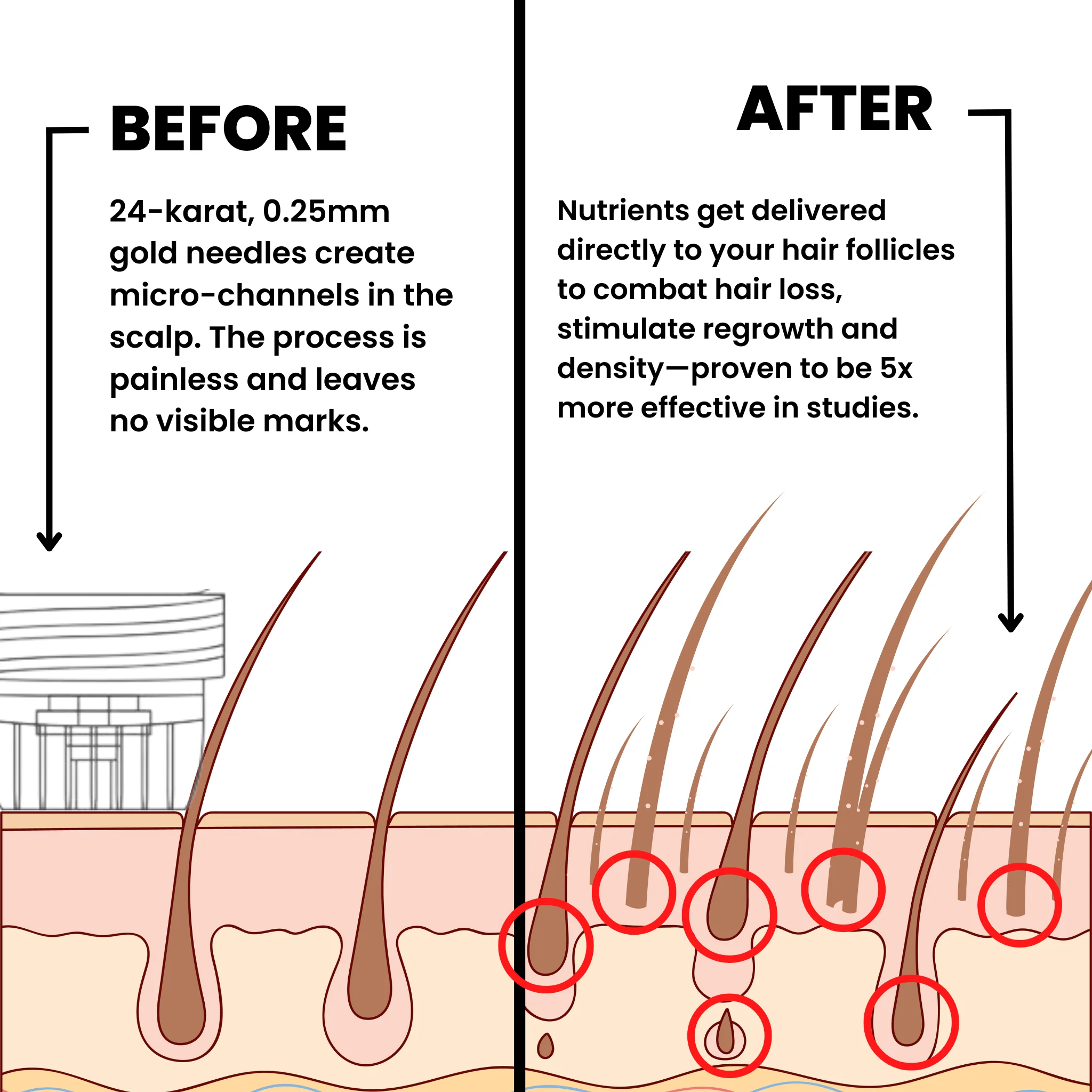 AlphaInfuse™ Hair Regrowth System Inbox - Image 2